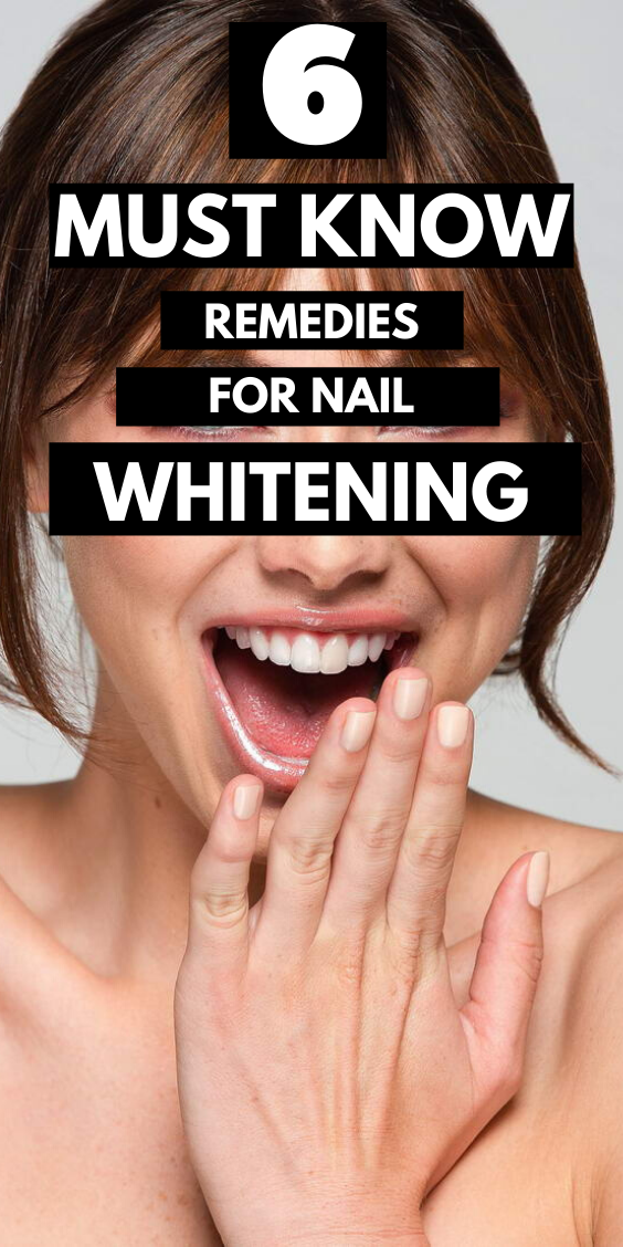 6 Nail Whitening Remedies You Must Try 1